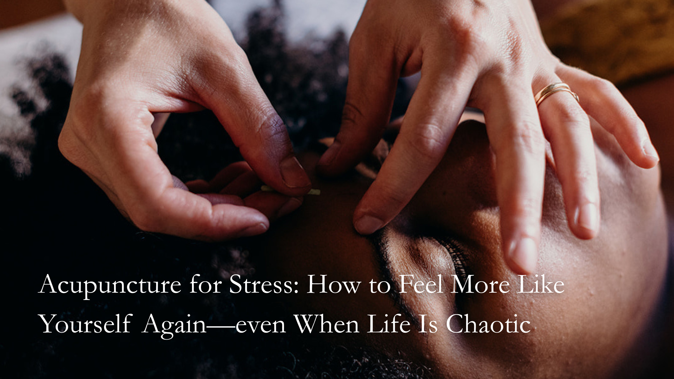 Acupuncture for Stress