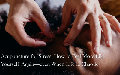 Acupuncture for Stress Relief in Tigard | Nervous System & Somatic Care
